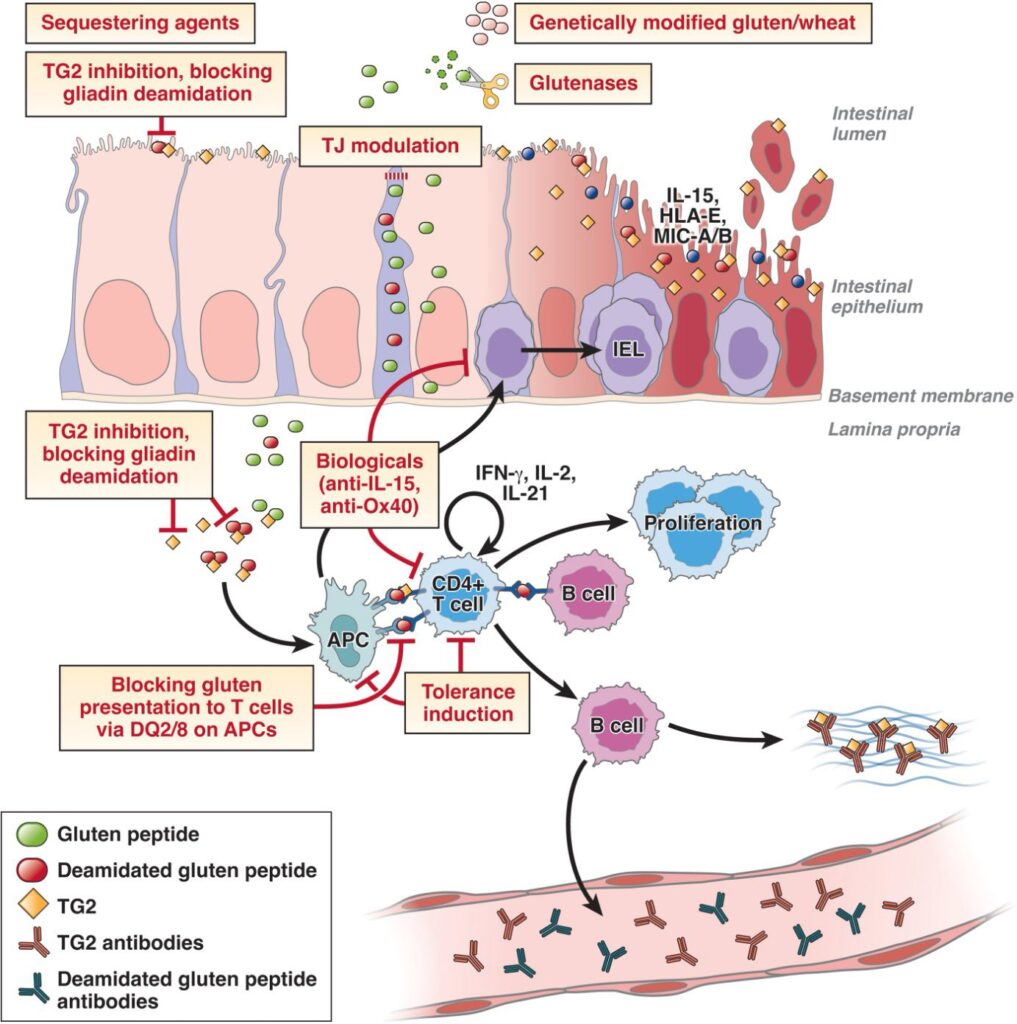 Novel Therapeutic Strategies in Celiac Disease